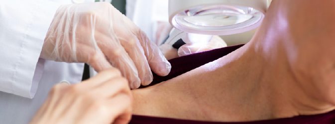 Skin Biopsies